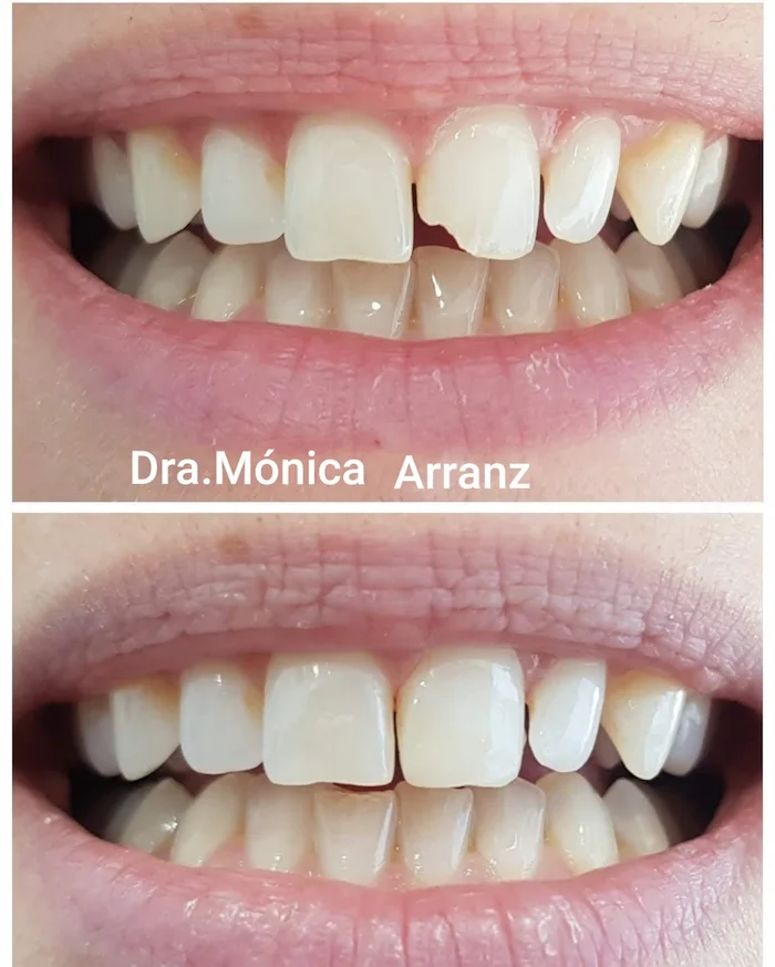 casos dentales odontoestetica dentistas en tres cantos